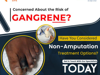 Gangrene treatment in india