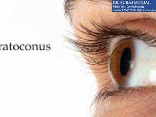 Keratoconus Surgery in India