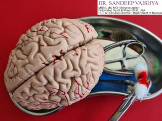 Deep Brain Stimulation Surgery in India