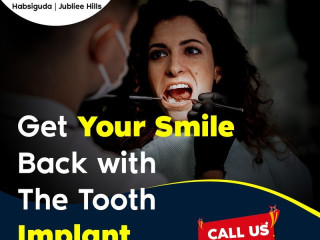 Get Your Smile Back with the Best Dentist for Dental Implants