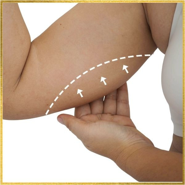 Achieve Sculpted Perfection with Liposuction Fat Transfer in Los Angeles