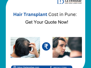 Understanding Hair Transplant Costs in Pune, Thane, and Navi Mumbai with La Densitae