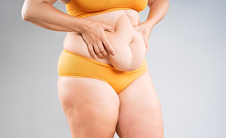 How Painful is a Tummy Tuck?