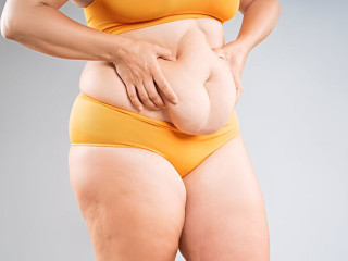 How Painful is a Tummy Tuck?