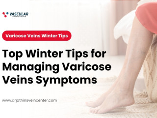 How to Stay Comfortable with Varicose Veins in Winter