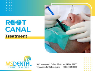 Root Canal Treatment in Fletcher - MS Dental Root Canal Treatment