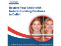 restore-your-smile-with-natural-looking-dentures-in-delhi-small-0