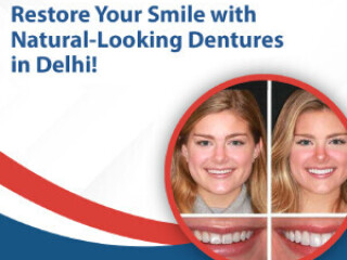 Restore Your Smile with Natural-Looking Dentures in Delhi!