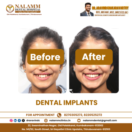 dental-clinics-in-kumbakonam-nalamm-dental-hospital