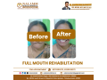 dental-clinics-in-kumbakonam-nalamm-dental-hospital-small-0