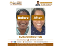 dental-clinics-in-kumbakonam-nalamm-dental-hospital-small-2