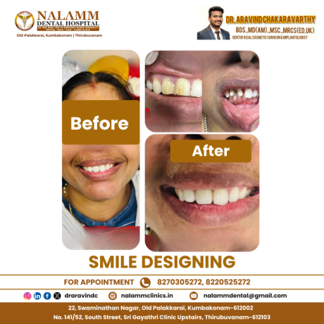 dental-clinics-in-kumbakonam-nalamm-dental-hospital-big-4