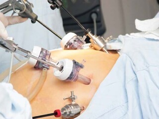 Best Laparoscopic Surgeon in Kolkata