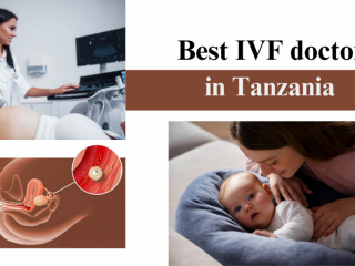 Best IVF doctor in Tanzania