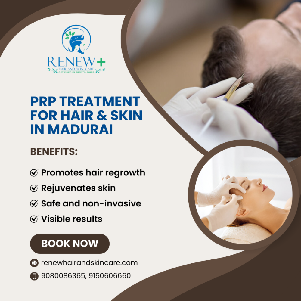 Hair prp treatment in Madurai - Renew Hair and Skin Care