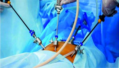 Advanced Laparoscopic Surgery Center in Kolkata