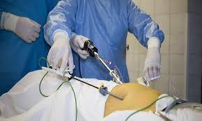 Premier Laparoscopic Surgery at Genesis Hospital, Kolkata