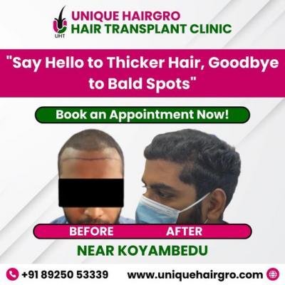 Best hair care clinic chennai