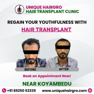 Best hair care clinic chennai