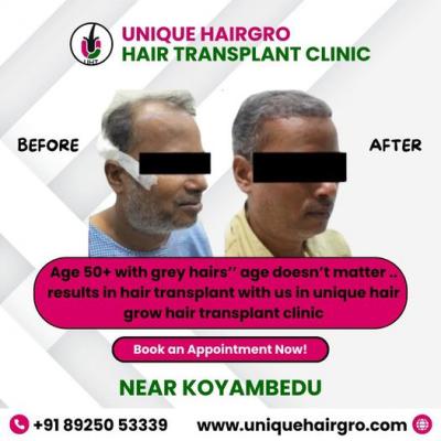 Best hair care clinic chennai