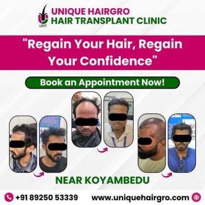 Hair transplant cost in chennai