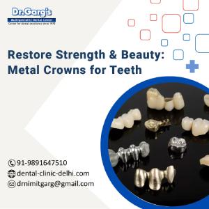 Restore Strength &amp; Beauty: Metal Crowns for Teeth