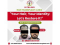 best-hair-transplant-clinic-in-tamilnadu-small-1