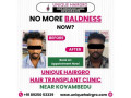 hair-transplant-cost-in-chennai-small-3