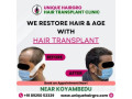 hair-transplant-cost-in-chennai-small-0