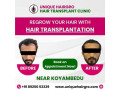 best-hair-transplant-doctors-near-me-small-3