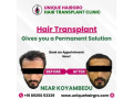 best-hair-transplant-doctors-near-me-small-1