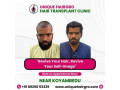 best-hair-transplant-clinic-in-tamilnadu-small-0