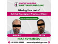 best-hair-transplant-clinic-in-tamilnadu-small-2