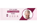 hair-transplant-cost-in-hyderabad-small-0