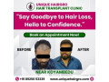 best-hair-care-clinic-chennai-small-3