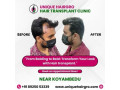 best-hair-care-clinic-chennai-small-1