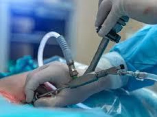 Leading Laparoscopic Surgeon in Kolkata - Dr. Purnendu Roy