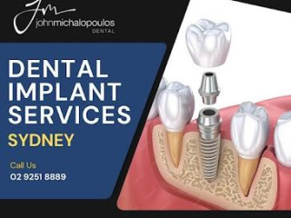 Secure &amp; Comfortable Dental Implants | Dr. JM Dental, Sydney’s Top Choice