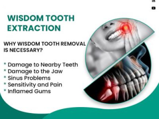 Wisdom Tooth Removal Treatment In Nagaram, Hyderabad | RISUS DENTAL 