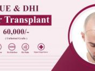 Hair transplant cost in hyderabad