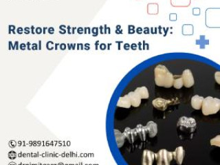 Restore Strength &amp; Beauty: Metal Crowns for Teeth