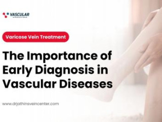  Prevent Complications with Early Varicose Vein Detection and Laser Therapy