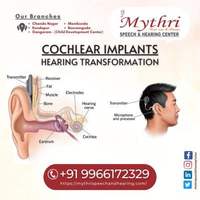 cochlear-implants-cochlear-implants-assessment-cochlear-implant-surgery-in-hyderabad-big-0