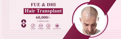 hair-transplant-cost-in-hyderabad-big-0