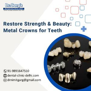 restore-strength-amp-beauty-metal-crowns-for-teeth-big-0