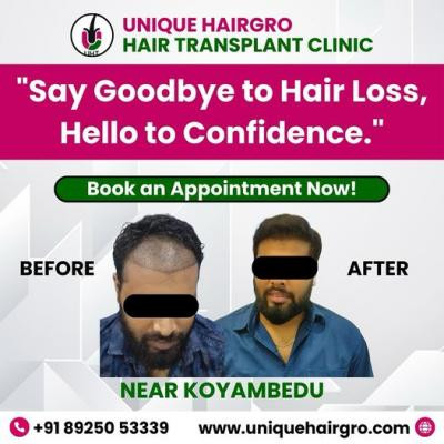 best-hair-care-clinic-chennai-big-3