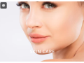 advanced-hair-and-skin-treatment-clinic-in-hyderabad-small-1