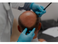 advanced-hair-and-skin-treatment-clinic-in-hyderabad-small-0